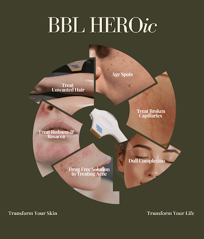 BBL HEROic™ treatment benefits